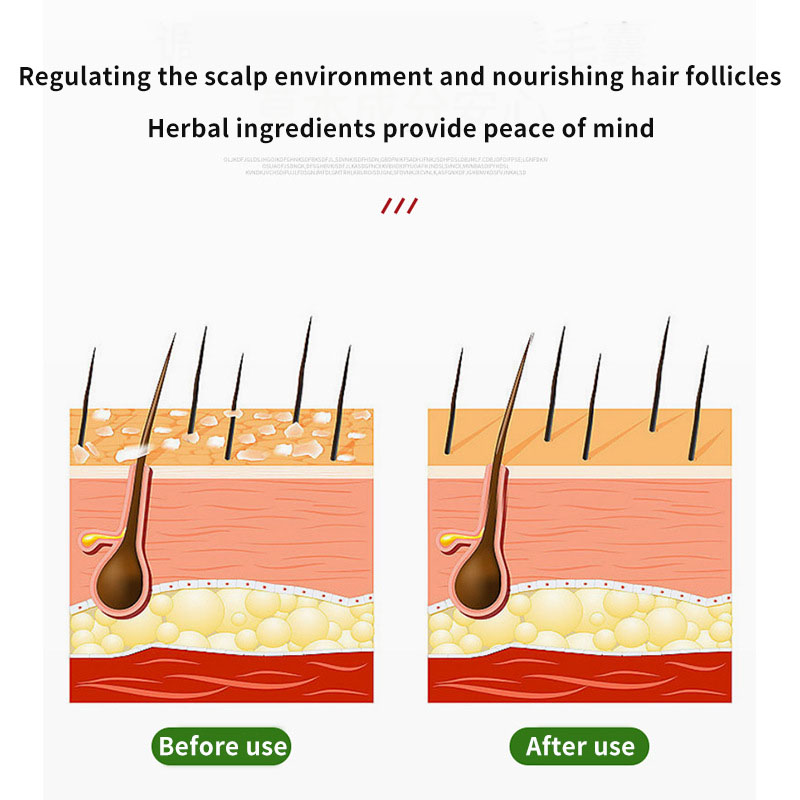Sophora Flavescens Hair Follic - đánh giá và giá Hair Care Oil
