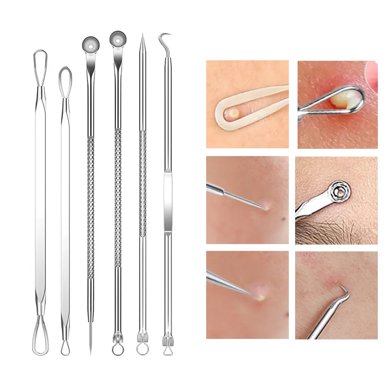 4-11Pcs Ingrown Hair Tweezers  - đánh giá và giá Hair Care Clinic
